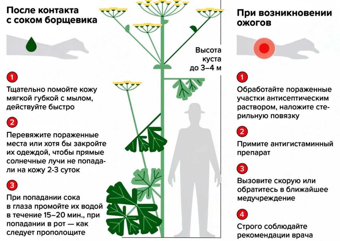 Ожог борщевика: первая помощь